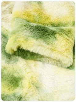 Kollyy Casual Yellow Top Outwear -Tops Sales ee48aaf87596f666ab06fd423eaff8d2